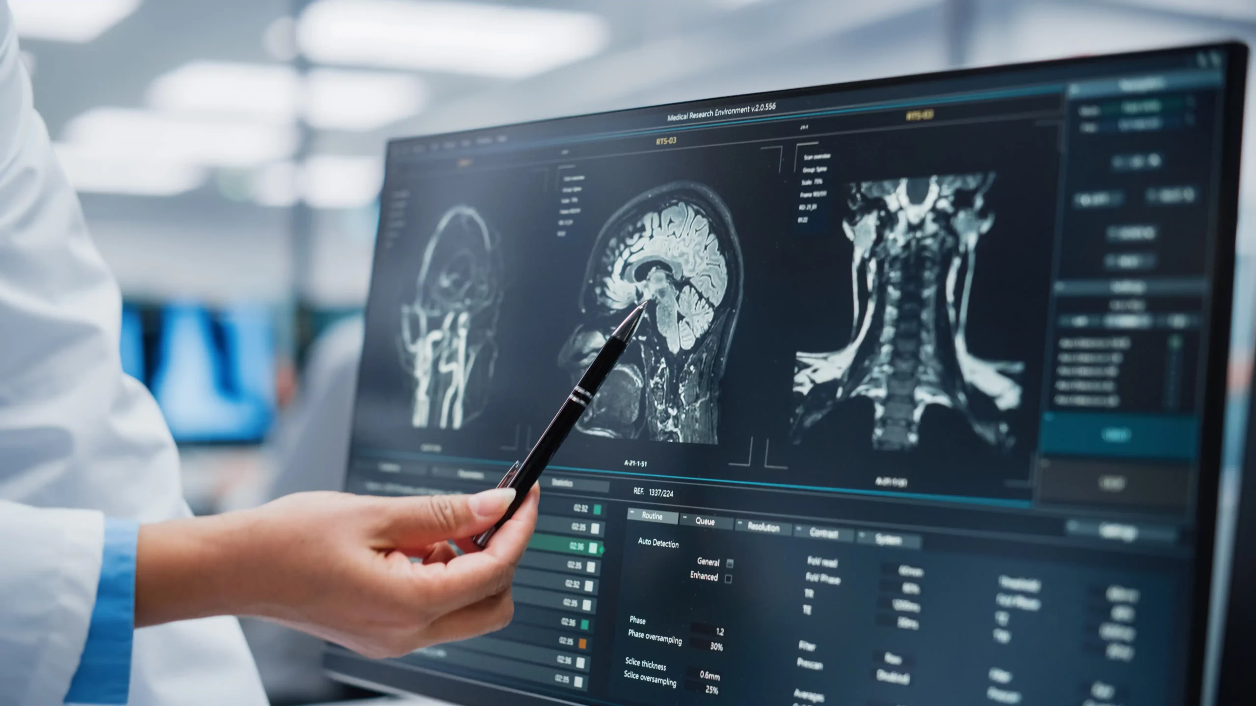 brain injury scan for lawsuit