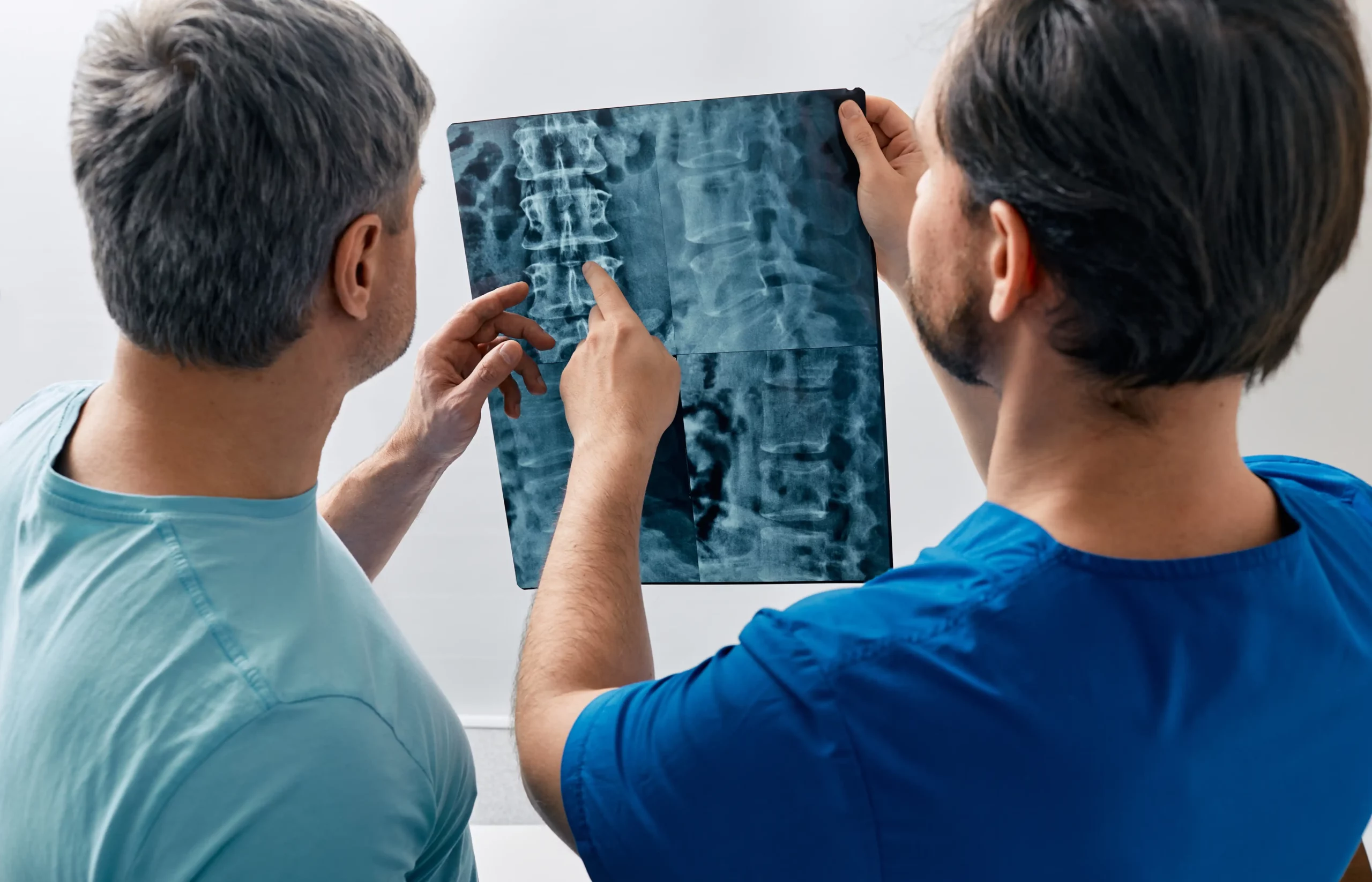 Doctor holding x-ray for a spinal cord injury lawsuit