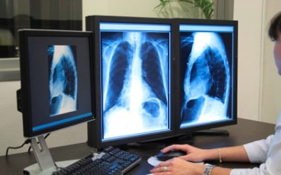 Radiology/Diagnostic Testing