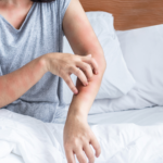 Understanding the Essentials of a Bed Bugs Lawsuit